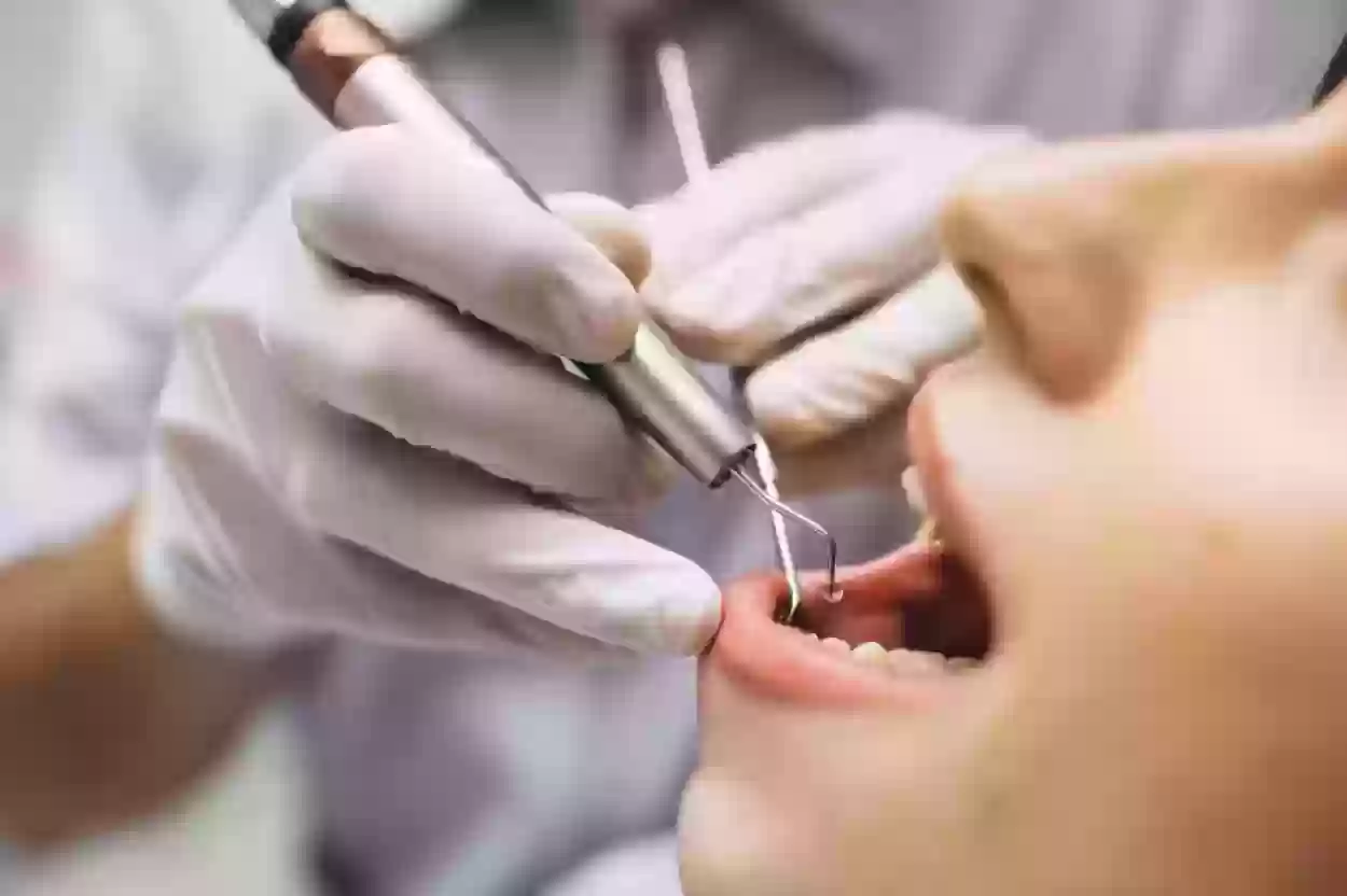 أفضل 15 مستشفى أسنان في الرياض 1445 وطرق التواصل