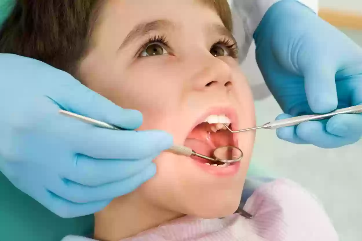 أقرب طبيب أسنان للأطفال من موقعي في الدمام وطريقة الحجز إلكترونيًا